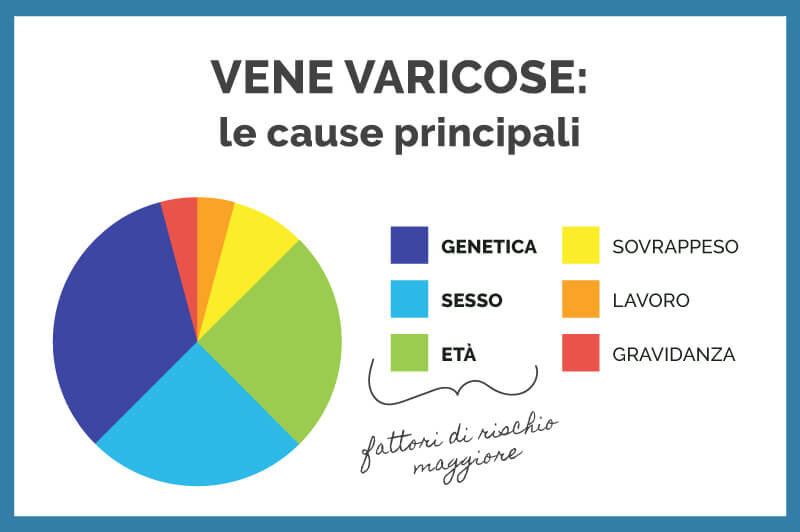 Vene Varicose Cause Principali